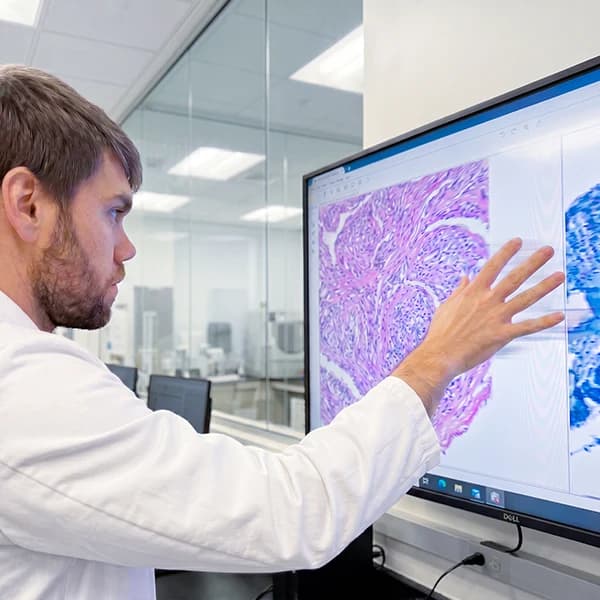 Dr. Charles Parrish reviews slides at Skyway DermPath lab